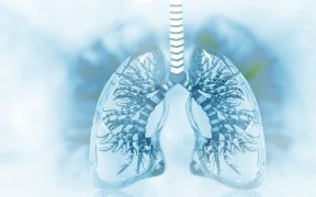 Grafika przedstawiająca zapalenie płuc