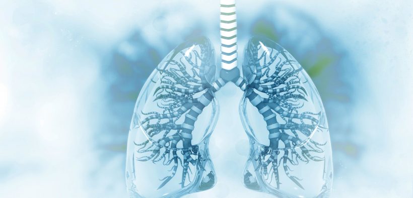 Grafika przedstawiająca zapalenie płuc